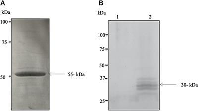 Identification and Characterization of P0 Protein as a Vaccine Candidate Against Babesia divergens, Blood Parasite of Veterinary and Zoonotic Importance